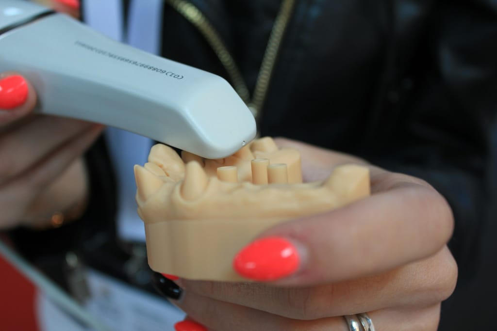 White intraoral scanner wand scanning a beige stone model of a lower arch with implant analogues, held in a hand.